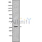 DF10185 at 1/100 staining Human lung cancer tissue by IHC-P. The sample was formaldehyde fixed and a heat mediated antigen retrieval step in citrate buffer was performed. The sample was then blocked and incubated with the antibody for 1.5 hours at 22¡ãC. An HRP conjugated goat anti-rabbit antibody was used as the secondary