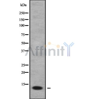 Western blot analysis FDCSP using HepG2 whole cell lysates