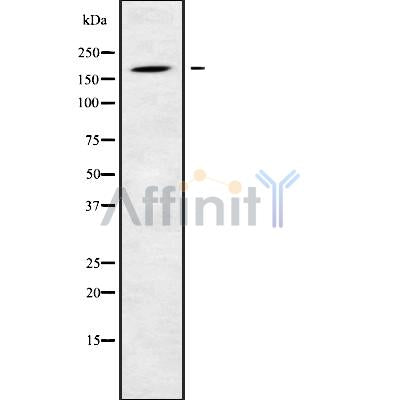 DF10191 at 1/100 staining Human Melanoma tissue by IHC-P. The sample was formaldehyde fixed and a heat mediated antigen retrieval step in citrate buffer was performed. The sample was then blocked and incubated with the antibody for 1.5 hours at 22¡ãC. An HRP conjugated goat anti-rabbit antibody was used as the secondary