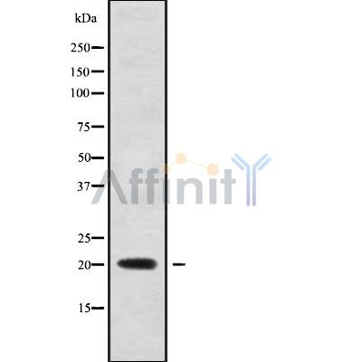 DF10193 staining Hela by IF/ICC. The sample were fixed with PFA and permeabilized in 0.1% Triton X-100,then blocked in 10% serum for 45 minutes at 25¡ãC. The primary antibody was diluted at 1/200 and incubated with the sample for 1 hour at 37¡ãC. An  Alexa Fluor 594 conjugated goat anti-rabbit IgG (H+L) Ab, diluted at 1/600, was used as the secondary antibod