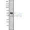 Western blot analysis of HTR3B using K562 whole cell lysates