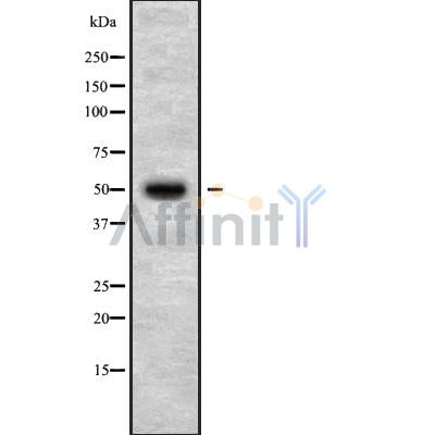 Western blot analysis of HTR3B using K562 whole cell lysates