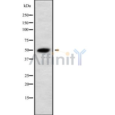 Western blot analysis of extracts from various samples, using HTR3D Antibody.
 Lane 1: Sp2/0 treated with blocking peptide.
 Lane 2: Sp2/0;
 Lane 3: 293;
 