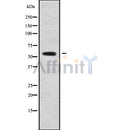 Western blot analysis of CALCRL using 293 whole cell lysates