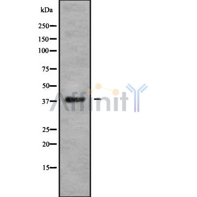 Western blot analysis of CCR10 using COLO205 whole cell lysates