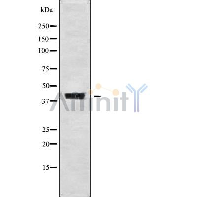 DF10206 at 1/100 staining Human liver cancer tissue by IHC-P. The sample was formaldehyde fixed and a heat mediated antigen retrieval step in citrate buffer was performed. The sample was then blocked and incubated with the antibody for 1.5 hours at 22¡ãC. An HRP conjugated goat anti-rabbit antibody was used as the secondary