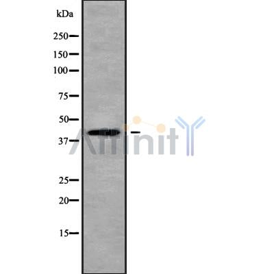 Western blot analysis of CCR6 using HT-29 whole cell lysates