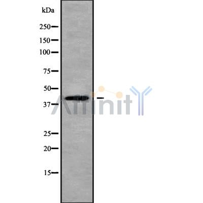 Western blot analysis of CCR6 using HT-29 whole cell lysates
