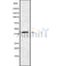 Western blot analysis of CCR8 using COLO205 whole cell lysates