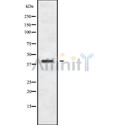 Western blot analysis of CCR8 using COLO205 whole cell lysates