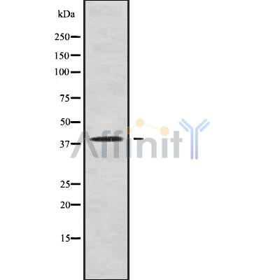 Western blot analysis of C5AR1 using HUVEC whole cell lysates