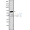 Western blot analysis GLP2R using 293 whole cell lysates