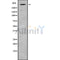 Western blot analysis GPR112 using COLO205 whole cell lysates