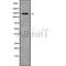 Western blot analysis GPR125 using HUVEC whole cell lysates