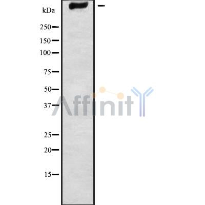 Western blot analysis GPR98 using K562 whole cell lysates