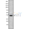 Western blot analysis of extracts from rat muscle, using OR4C46 Antibody.