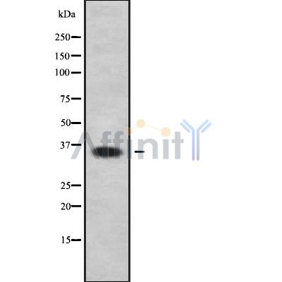 Western blot analysis of extracts from rat muscle, using OR4C46 Antibody.