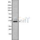 Western blot analysis of extracts from mouse liver and HepG2 and rat muscle and mouse spleen, using OR4F15 Antibody.