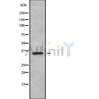 Western blot analysis of extracts from mouse liver and HepG2 and rat muscle and mouse spleen, using OR4F15 Antibody.