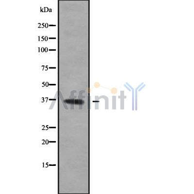 Western blot analysis of extracts from mouse liver and HepG2 and rat muscle and mouse spleen, using OR52E6/52E8 Antibody.