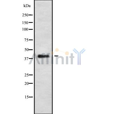 Western blot analysis of extracts from rat brain, using OPSB Antibody.