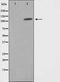 AF0822 staining HepG2 by IF/ICC. The sample were fixed with PFA and permeabilized in 0.1% Triton X-100,then blocked in 10% serum for 45 minutes at 25¡ãC. The primary antibody was diluted at 1/200 and incubated with the sample for 1 hour at 37¡ãC. An  Alexa Fluor 594 conjugated goat anti-rabbit IgG (H+L) Ab, diluted at 1/600, was used as the secondary antibod
