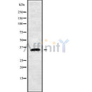 DF10244 at 1/100 staining Human liver cancer tissue by IHC-P. The sample was formaldehyde fixed and a heat mediated antigen retrieval step in citrate buffer was performed. The sample was then blocked and incubated with the antibody for 1.5 hours at 22¡ãC. An HRP conjugated goat anti-rabbit antibody was used as the secondary