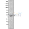 Western blot analysis OR using HeLa whole cell lysates