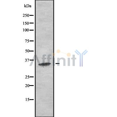 Western blot analysis OR using HeLa whole cell lysates