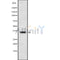 Western blot analysis of extracts from HUVEC, using OR4D9 Antibody. The lane on the left was treated with blocking peptide.