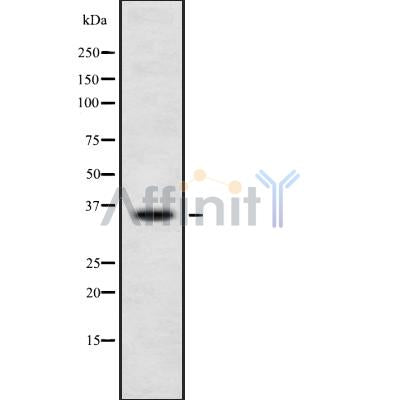 Western blot analysis of extracts from HUVEC, using OR4D9 Antibody. The lane on the left was treated with blocking peptide.