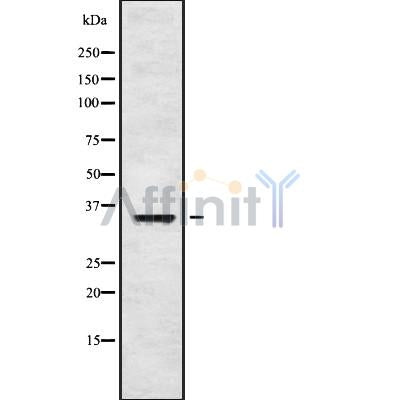 Western blot analysis OR5L1/2 using HUVEC whole cell lysates