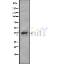 DF10255 staining Hela by IF/ICC. The sample were fixed with PFA and permeabilized in 0.1% Triton X-100,then blocked in 10% serum for 45 minutes at 25¡ãC. The primary antibody was diluted at 1/200 and incubated with the sample for 1 hour at 37¡ãC. An  Alexa Fluor 594 conjugated goat anti-rabbit IgG (H+L) Ab, diluted at 1/600, was used as the secondary antibod