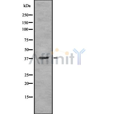 Western blot analysis of extracts from Hybridoma cells, using OR5T3 Antibody. The lane on the left was treated with blocking peptide.
