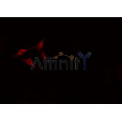 AF0176 staining A549? cells by IF/ICC. The sample were fixed with PFA and permeabilized in 0.1% Triton X-100,then blocked in 10% serum for 45 minutes at 25¡ãC. The primary antibody was diluted at 1/200 and incubated with the sample for 1 hour at 37¡ãC. An  Alexa Fluor 594 conjugated goat anti-rabbit IgG (H+L) antibody(Cat.