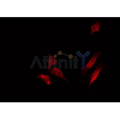 AF0176 staining COS7 by IF/ICC. The sample were fixed with PFA and permeabilized in 0.1% Triton X-100,then blocked in 10% serum for 45 minutes at 25¡ãC. The primary antibody was diluted at 1/200 and incubated with the sample for 1 hour at 37¡ãC. An  Alexa Fluor 594 conjugated goat anti-rabbit IgG (H+L) Ab, diluted at 1/600, was used as the secondary antibod