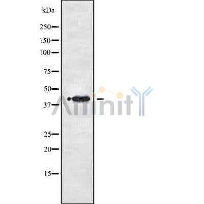 Western blot analysis of P2RY1 using COLO205 whole cell lysates