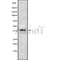 Western blot analysis of extracts from HUVEC, using P2RY5 Antibody. The lane on the left was treated with blocking peptide.