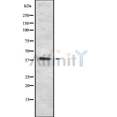 Western blot analysis of extracts from HUVEC, using P2RY5 Antibody. The lane on the left was treated with blocking peptide.