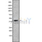 DF10261 at 1/100 staining Human liver cancer tissue by IHC-P. The sample was formaldehyde fixed and a heat mediated antigen retrieval step in citrate buffer was performed. The sample was then blocked and incubated with the antibody for 1.5 hours at 22¡ãC. An HRP conjugated goat anti-rabbit antibody was used as the secondary