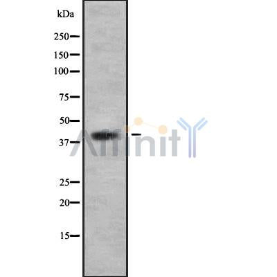 DF10261 at 1/100 staining Human liver cancer tissue by IHC-P. The sample was formaldehyde fixed and a heat mediated antigen retrieval step in citrate buffer was performed. The sample was then blocked and incubated with the antibody for 1.5 hours at 22¡ãC. An HRP conjugated goat anti-rabbit antibody was used as the secondary