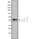 Western blot analysis of extracts from Rat brain, using P2RY10 Antibody. The lane on the left was treated with blocking peptide.