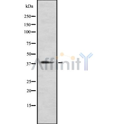 Western blot analysis of extracts from K562, using P2RY12 Antibody. The lane on the left was treated with blocking peptide.