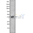 DF10267 at 1/100 staining Human Head and neck cancer tissue by IHC-P. The sample was formaldehyde fixed and a heat mediated antigen retrieval step in citrate buffer was performed. The sample was then blocked and incubated with the antibody for 1.5 hours at 22¡ãC. An HRP conjugated goat anti-rabbit antibody was used as the secondary