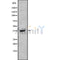 DF10267 at 1/100 staining Human Head and neck cancer tissue by IHC-P. The sample was formaldehyde fixed and a heat mediated antigen retrieval step in citrate buffer was performed. The sample was then blocked and incubated with the antibody for 1.5 hours at 22¡ãC. An HRP conjugated goat anti-rabbit antibody was used as the secondary