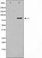 AF0704 staining Hela by IF/ICC. The sample were fixed with PFA and permeabilized in 0.1% Triton X-100,then blocked in 10% serum for 45 minutes at 25¡ãC. The primary antibody was diluted at 1/200 and incubated with the sample for 1 hour at 37¡ãC. An  Alexa Fluor 594 conjugated goat anti-rabbit IgG (H+L) Ab, diluted at 1/600, was used as the secondary antibod