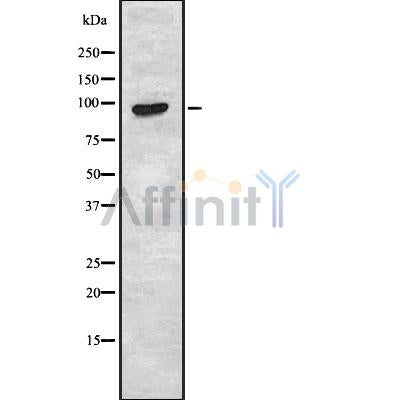 Western blot analysis of extracts from HUVEC, using TAS1R2 Antibody. The lane on the left was treated with blocking peptide.