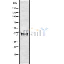 DF10283 staining Hela by IF/ICC. The sample were fixed with PFA and permeabilized in 0.1% Triton X-100,then blocked in 10% serum for 45 minutes at 25¡ãC. The primary antibody was diluted at 1/200 and incubated with the sample for 1 hour at 37¡ãC. An  Alexa Fluor 594 conjugated goat anti-rabbit IgG (H+L) Ab, diluted at 1/600, was used as the secondary antibod