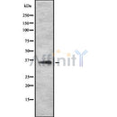 DF10284 at 1/100 staining Human liver cancer tissue by IHC-P. The sample was formaldehyde fixed and a heat mediated antigen retrieval step in citrate buffer was performed. The sample was then blocked and incubated with the antibody for 1.5 hours at 22¡ãC. An HRP conjugated goat anti-rabbit antibody was used as the secondary