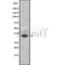 Western blot analysis of extracts from HUVEC, using OR52L2 Antibody. Lane 1 was treated with the blocking peptide.